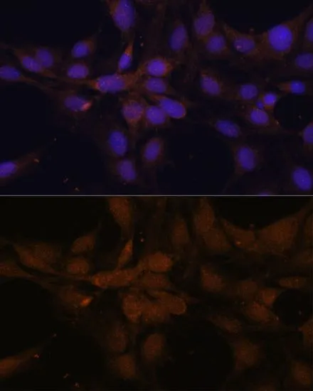 ICC/IF analysis of C6 cells using GTX64336 YAP1 antibody. Blue : DAPI Dilution : 1:100