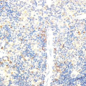IHC-P analysis of mouse spleen tissue using GTX64343 FOXP3 antibody. Dilution : 1:100