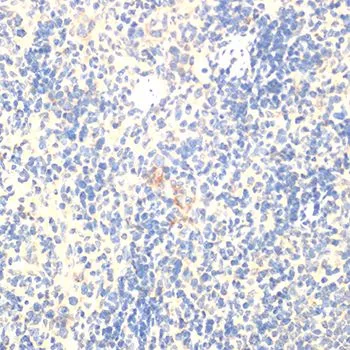 IHC-P analysis of rat spleen tissue using GTX64343 FOXP3 antibody. Dilution : 1:100