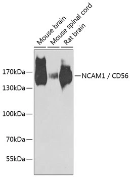 WB analysis of various sample lysates using GTX64346 NCAM antibody. Dilution : 1:1000 Loading : 25microg per lane WB analysis of various sample lysates using GTX64346 NCAM antibody. Dilution : 1:1000 Loading : 25microg per lane