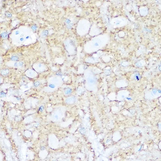 IHC-P analysis of rat brain tissue using GTX64346 NCAM antibody. Dilution : 1:100