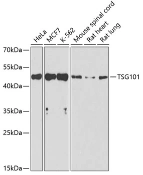 WB analysis of various sample lysates using GTX64349 TSG101 antibody. Dilution : 1:1000 Loading : 25microg per lane