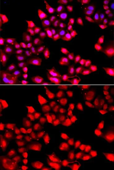 ICC/IF analysis of A549 cells using GTX64359 Ku70 antibody. Blue : DAPI