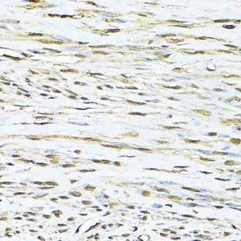 IHC-P analysis of human uterus tissue using GTX64359 Ku70 antibody. Dilution : 1:100