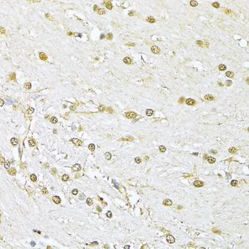 IHC-P analysis of rat brain tissue using GTX64359 Ku70 antibody. Dilution : 1:100