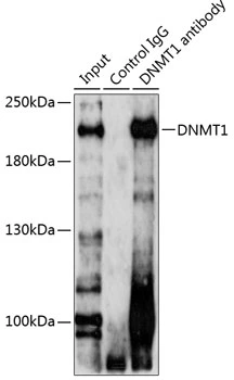 IP analysis of 293T cell lysate using GTX64361 DNMT1 antibody. Antibody amount : 3microg / 200microg lysate Dilution : 1:1000 IP analysis of 293T cell lysate using GTX64361 DNMT1 antibody. Antibody amount : 3microg / 200microg lysate Dilution : 1:1000