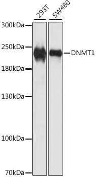 WB analysis of various sample lysates using GTX64361 DNMT1 antibody. Dilution : 1:1000 Loading : 25microg per lane