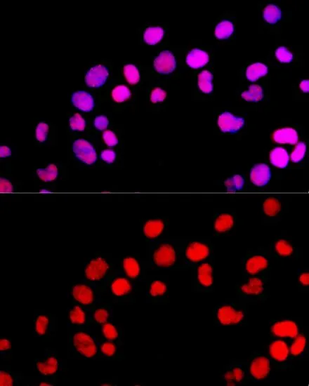 ICC/IF analysis of 293T cells using GTX64361 DNMT1 antibody. Blue : DAPI Dilution : 1:100
