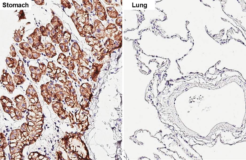Anti-Claudin 18.2 antibody [GT206] (GTX643617) | GeneTex