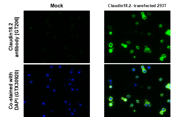 Anti-Claudin 18.2 antibody [GT206] (GTX643617) | GeneTex