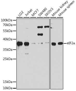 WB analysis of various sample lysates using GTX64363 eIF2 alpha antibody. Dilution : 1:1000 Loading : 25microg per lane WB analysis of various sample lysates using GTX64363 eIF2 alpha antibody. Dilution : 1:1000 Loading : 25microg per lane