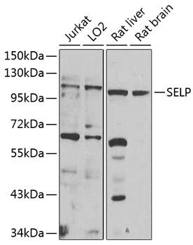 WB analysis of various sample lysates using GTX64365 CD62P antibody. The signal was developed with ECL plus-Enhanced. Dilution : 1:1000 Loading : 25microg per lane WB analysis of various sample lysates using GTX64365 CD62P antibody. The signal was developed with ECL plus-Enhanced. Dilution : 1:1000 Loading : 25microg per lane