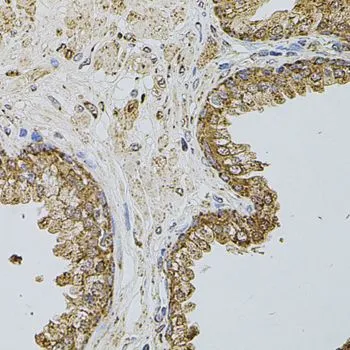 IHC-P analysis of human prostate tissue using GTX64365 CD62P antibody. Dilution : 1:100
