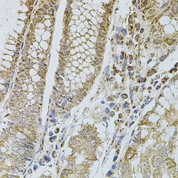 IHC-P analysis of human stomach tissue using GTX64365 CD62P antibody. Dilution : 1:100