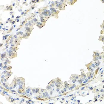 IHC-P analysis of mouse lung tissue using GTX64371 IL22 antibody. Dilution : 1:100 IHC-P analysis of mouse lung tissue using GTX64371 IL22 antibody. Dilution : 1:100