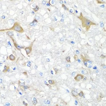 IHC-P analysis of rat brain tissue using GTX64371 IL22 antibody. Dilution : 1:100