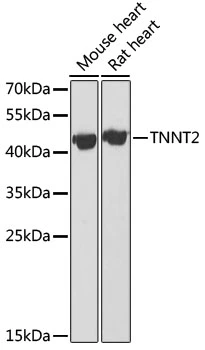 WB analysis of various sample lysates using GTX64380 Cardiac Troponin T antibody. Dilution : 1:1000 Loading : 25microg per lane WB analysis of various sample lysates using GTX64380 Cardiac Troponin T antibody. Dilution : 1:1000 Loading : 25microg per lane