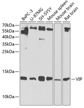 WB analysis of various sample lysates using GTX64386 VIP antibody. Dilution : 1:1000 Loading : 25microg per lane WB analysis of various sample lysates using GTX64386 VIP antibody. Dilution : 1:1000 Loading : 25microg per lane
