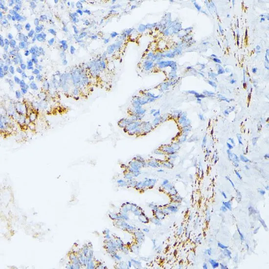 IHC-P analysis of rat lung tissue using GTX64388 IL3 Receptor alpha antibody. Dilution : 1:100