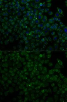 ICC/IF analysis of HeLa cells using GTX64392 Angiogenin antibody. Blue : DAPI ICC/IF analysis of HeLa cells using GTX64392 Angiogenin antibody. Blue : DAPI