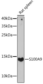 WB analysis of rat spleen tissue lysate using GTX64397 S100A9 antibody. Dilution : 1:1000 Loading : 25microg per lane