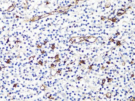 IHC-P analysis of human tonsil tissue using GTX64397 S100A9 antibody. Dilution : 1:100