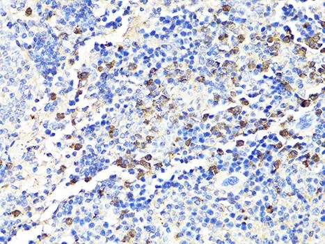 IHC-P analysis of mouse spleen tissue using GTX64397 S100A9 antibody. Dilution : 1:100