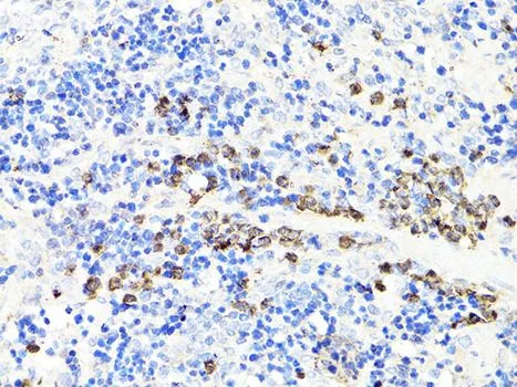 IHC-P analysis of rat spleen tissue using GTX64397 S100A9 antibody. Dilution : 1:100