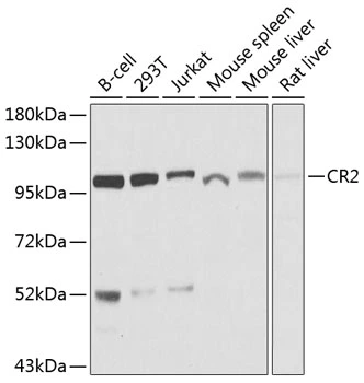 WB analysis of various sample lysates using GTX64400 CD21 antibody. Dilution : 1:1000 Loading : 25microg per lane WB analysis of various sample lysates using GTX64400 CD21 antibody. Dilution : 1:1000 Loading : 25microg per lane