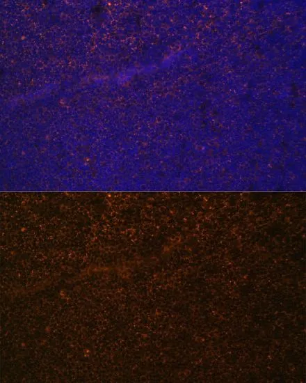 IHC-P analysis of mouse spleen tissue using GTX64400 CD21 antibody. Blue : DAPI Dilution : 1:100