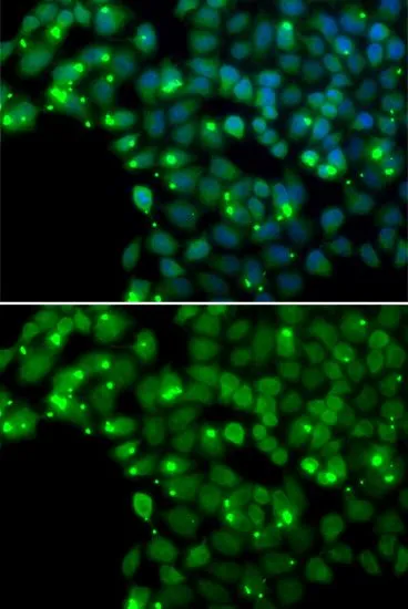 ICC/IF analysis of U2OS cells using GTX64402 MGMT antibody. Blue : DAPI