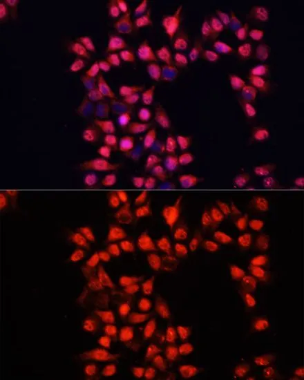 ICC/IF analysis of HeLa cells using GTX64403 ADAM10 antibody. Blue : DAPI Dilution : 1:100