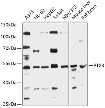 WB analysis of various sample lysates using GTX64405 Pentraxin 3 antibody. The signal was developed with ECL plus-Enhanced. Dilution : 1:3000 Loading : 25microg per lane WB analysis of various sample lysates using GTX64405 Pentraxin 3 antibody. The signal was developed with ECL plus-Enhanced. Dilution : 1:3000 Loading : 25microg per lane