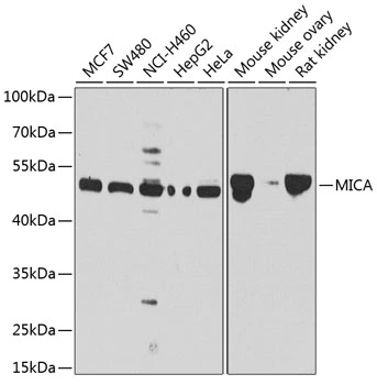 WB analysis of various sample lysates using GTX64407 MICA antibody. Dilution : 1:1000 Loading : 25microg per lane WB analysis of various sample lysates using GTX64407 MICA antibody. Dilution : 1:1000 Loading : 25microg per lane
