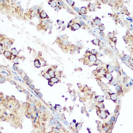 IHC-P analysis of mouse testis tissue using GTX64409 Diablo antibody. Dilution : 1:100