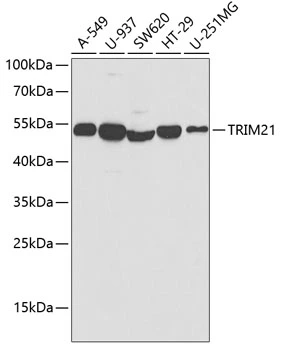 WB analysis of various sample lysates using GTX64414 SSA1 antibody. Dilution : 1:1000 Loading : 25microg per lane WB analysis of various sample lysates using GTX64414 SSA1 antibody. Dilution : 1:1000 Loading : 25microg per lane