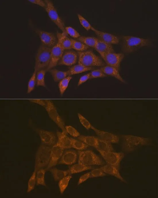 ICC/IF analysis of NIH/3T3 cells using GTX64414 SSA1 antibody. Blue : DAPI Dilution : 1:100