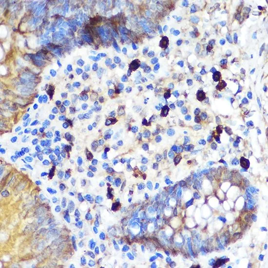 IHC-P analysis of human appendix tissue using GTX64414 SSA1 antibody. Dilution : 1:100