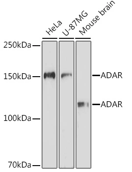 WB analysis of various sample lysates using GTX64415 ADAR1 antibody. Dilution : 1:1000 Loading : 25microg per lane WB analysis of various sample lysates using GTX64415 ADAR1 antibody. Dilution : 1:1000 Loading : 25microg per lane