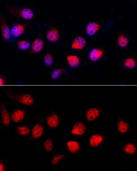 ICC/IF analysis of HeLa cells using GTX64415 ADAR1 antibody. Blue : DAPI Dilution : 1:100