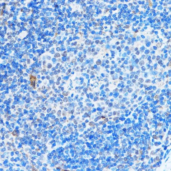 IHC-P analysis of mouse spleen tissue using GTX64415 ADAR1 antibody. Dilution : 1:100