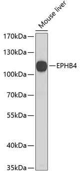 WB analysis of mouse liver tissue lysate using GTX64420 EphB4 antibody. Dilution : 1:1000 Loading : 25microg per lane WB analysis of mouse liver tissue lysate using GTX64420 EphB4 antibody. Dilution : 1:1000 Loading : 25microg per lane