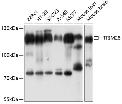WB analysis of various sample lysates using GTX64422 KAP1 antibody. Dilution : 1:1000 Loading : 25microg per lane WB analysis of various sample lysates using GTX64422 KAP1 antibody. Dilution : 1:1000 Loading : 25microg per lane