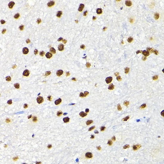 ICC/IF analysis of L929 cells using GTX64422 KAP1 antibody. Blue : DAPI Dilution : 1:100
