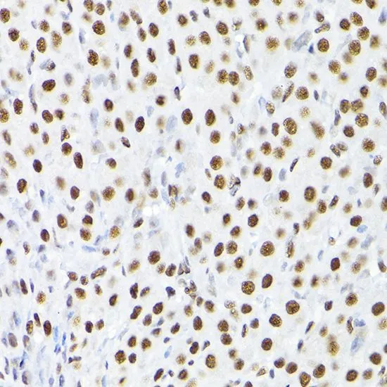 ICC/IF analysis of U2OS cells using GTX64422 KAP1 antibody. Blue : DAPI Dilution : 1:100