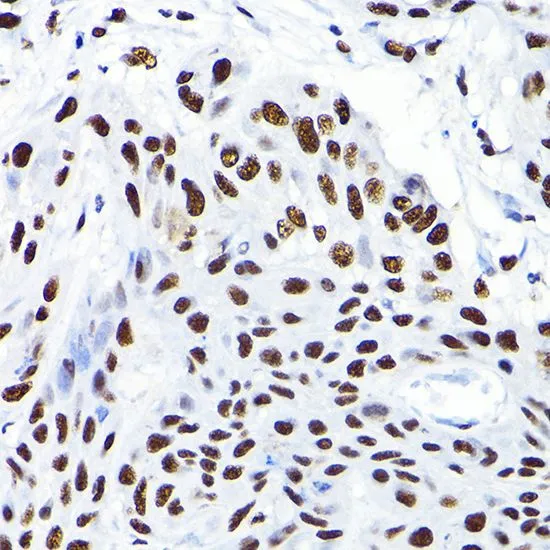 ICC/IF analysis of C6 cells using GTX64422 KAP1 antibody. Blue : DAPI Dilution : 1:100