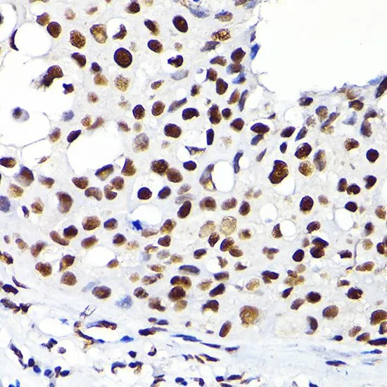 IHC-P analysis of rat brain tissue using GTX64422 KAP1 antibody. Dilution : 1:100
