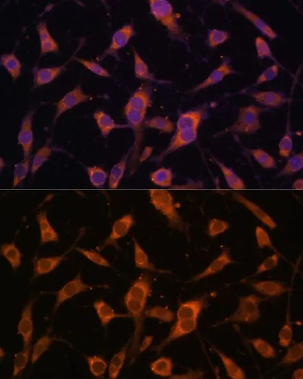 ICC/IF analysis of L929 cells using GTX64424 Fibulin 5 antibody. Blue : DAPI Dilution : 1:100