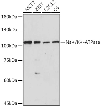 WB analysis of various sample lysates using GTX64425 Sodium/Potassium ATPase alpha 1 antibody. Dilution : 1:500 Loading : 25microg per lane WB analysis of various sample lysates using GTX64425 Sodium/Potassium ATPase alpha 1 antibody. Dilution : 1:500 Loading : 25microg per lane