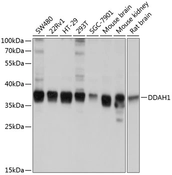 WB analysis of various sample lysates using GTX64427 DDAH1 antibody. Dilution : 1:1000 Loading : 25microg per lane WB analysis of various sample lysates using GTX64427 DDAH1 antibody. Dilution : 1:1000 Loading : 25microg per lane